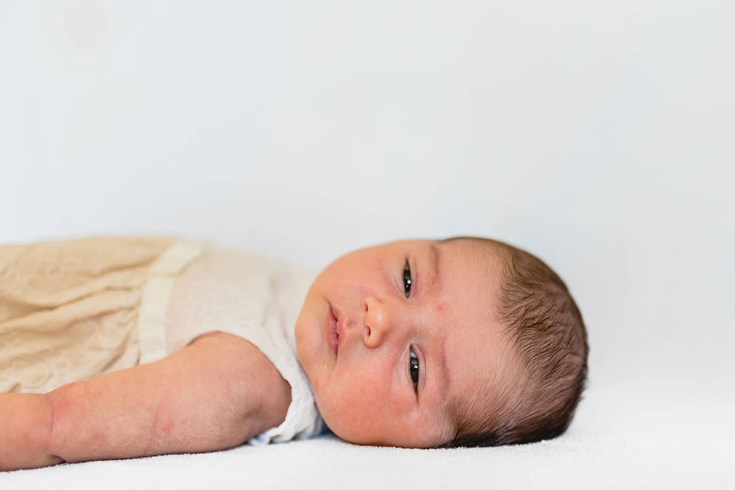 Flat baby store syndrome